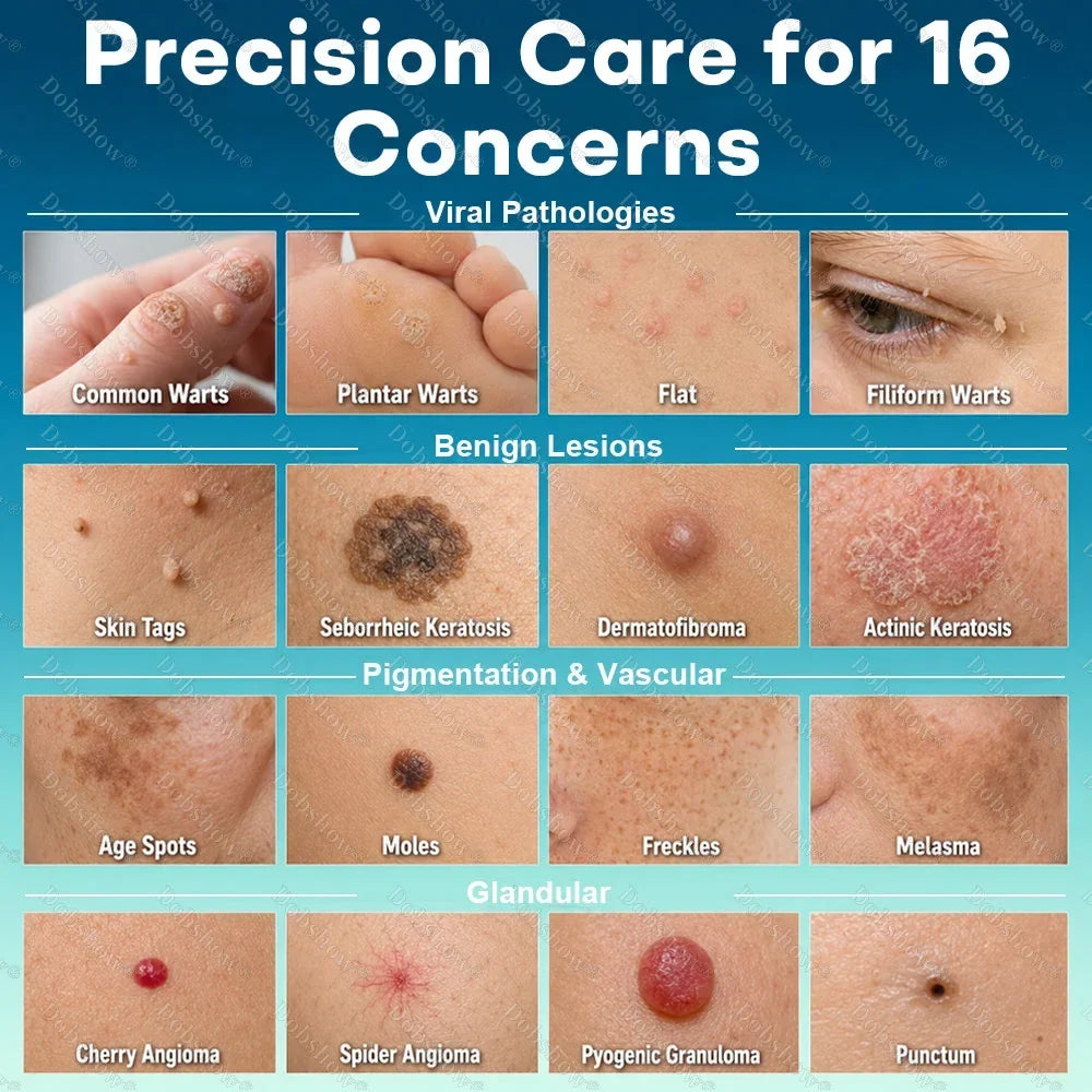 🔥100K+ SOLD 🔥 Dobshow® Newly Upgraded Precision Wart & Dark Spot Corrector Pen 🌿🎯