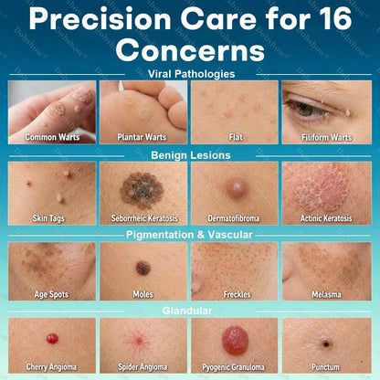 🔥100K+ SOLD 🔥 Dobshow® Newly Upgraded Precision Wart & Dark Spot Corrector Pen 🌿🎯