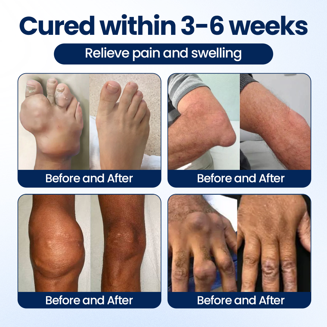 100K+ SOLD 🔥 Dobshow®   ArthriNAD+ Pro Advanced Joint Recovery Cream