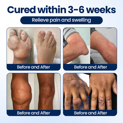100K+ SOLD 🔥 Dobshow®   ArthriNAD+ Pro Advanced Joint Recovery Cream