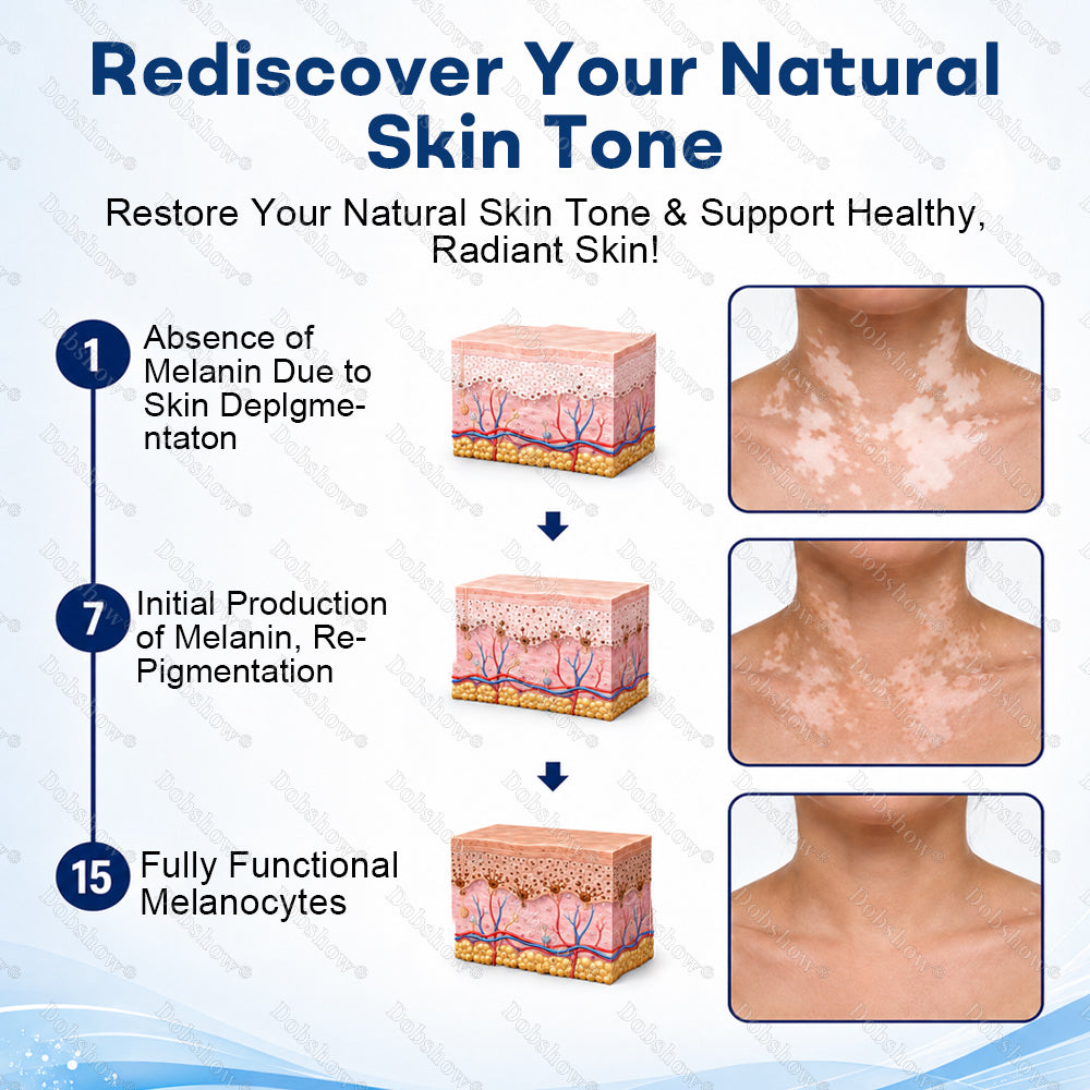 🔥100K+ SOLD Healrize® Piperine Vitiligo Repigmentation Spray - 👨‍⚕️✅Steroid-Free Botanical Formula | Gentle & Effective for All Skin Types