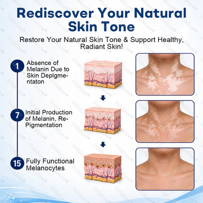 🔥100K+ SOLD Healrize® Piperine Vitiligo Repigmentation Spray - 👨‍⚕️✅Steroid-Free Botanical Formula | Gentle & Effective for All Skin Types
