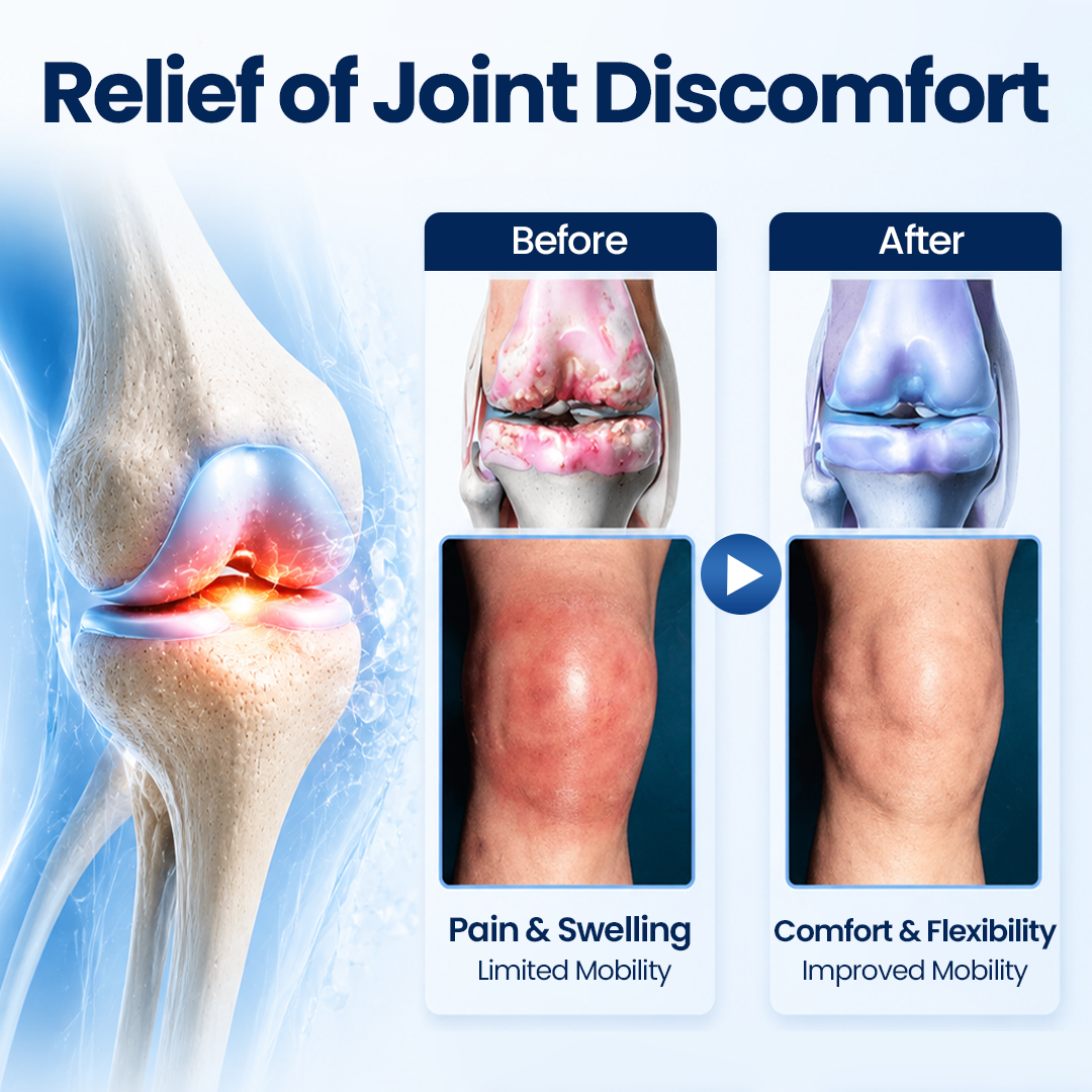100K+ SOLD 🔥 Dobshow®   ArthriNAD+ Pro Advanced Joint Recovery Cream