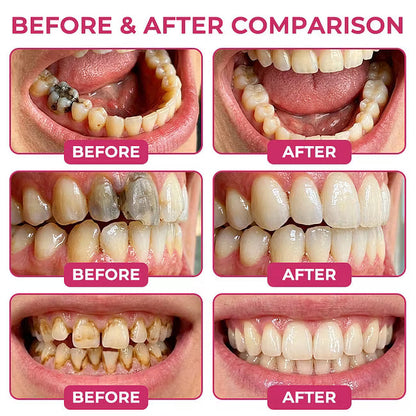 🏆𝐎𝐟𝐟𝐢𝐜𝐢𝐚𝐥 𝐔𝐒 𝐒𝐭𝐨𝐫𝐞🎉Over 100K+ Sold🔥Dobshow® 🦷 DenPerm Advanced Enamel Repair Biomimetic Protein Gel