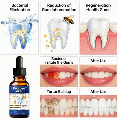 Dobshow™ Mint + Bee Venom Oral Repair Solution (50ml) - Whitening & Fresh Breath Mouthwash