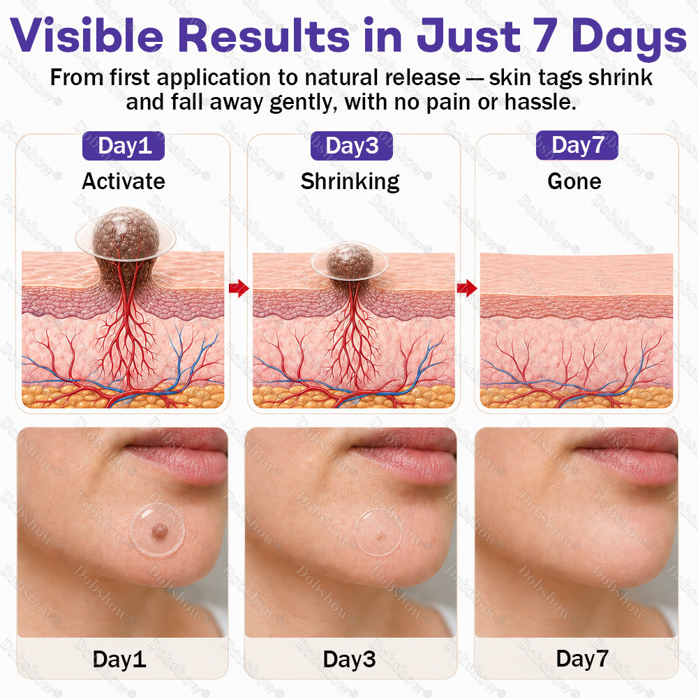 Dobshow®✨ All-New Upgraded Microneedle Wart Removal Patch — Invisible, Discreet Wart Care