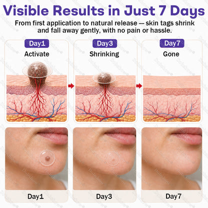 Dobshow®✨ All-New Upgraded Microneedle Wart Removal Patch — Invisible, Discreet Wart Care