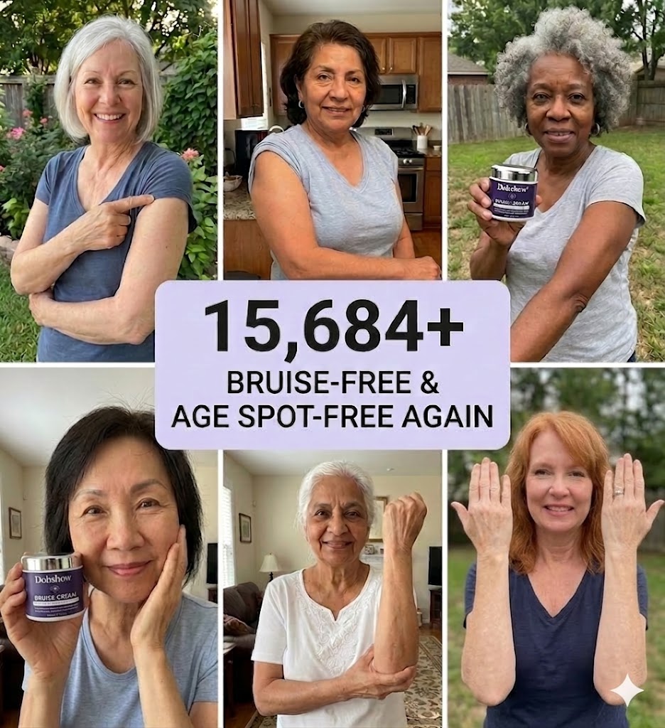🏆𝐎𝐟𝐟𝐢𝐜𝐢𝐚𝐥 𝐔𝐒 𝐒𝐭𝐨𝐫𝐞🎉Over 100K+ Sold🔥Dobshow® Dark Spot & Bruise Recovery Cream