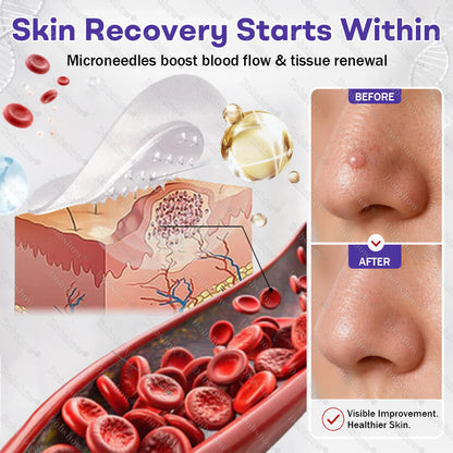 Dobshow®✨ All-New Upgraded Microneedle Wart Removal Patch — Invisible, Discreet Wart Care