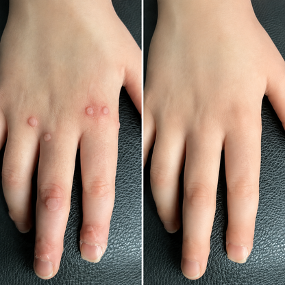 🔥 78K+ Sold! Dobshow® ✨ 2-in-1 Cryo-Cooling Bump Renewal Spray ☘️ Targets Skin Tags, Common Warts & Rough Bumps | Helps Improve the Look of Uneven, Rough Skin | Fast-Drying Formula for Face & Body