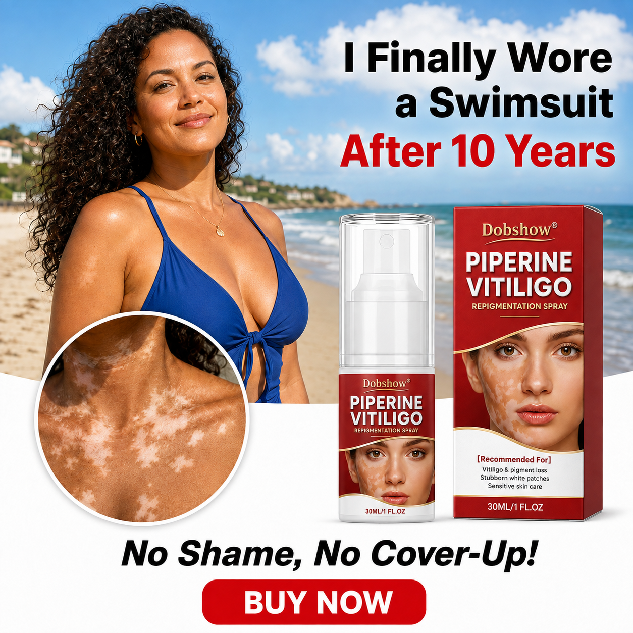 🔥100K+ SOLD | Dobshow® Advanced Piperine Vitiligo Repigmentation Spray — 👨‍⚕️✅Upgraded Steroid-Free Botanical Formula