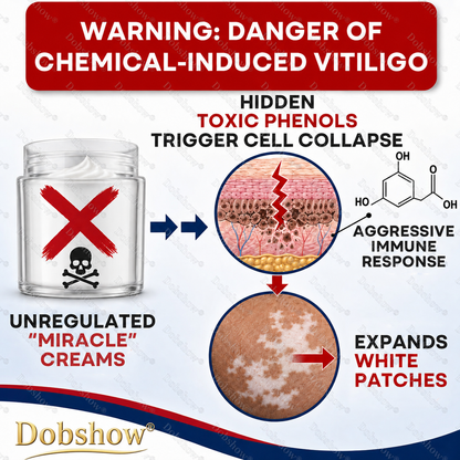 🔥100K+ SOLD | Dobshow® Advanced Piperine Vitiligo Repigmentation Spray — 👨‍⚕️✅Upgraded Steroid-Free Botanical Formula
