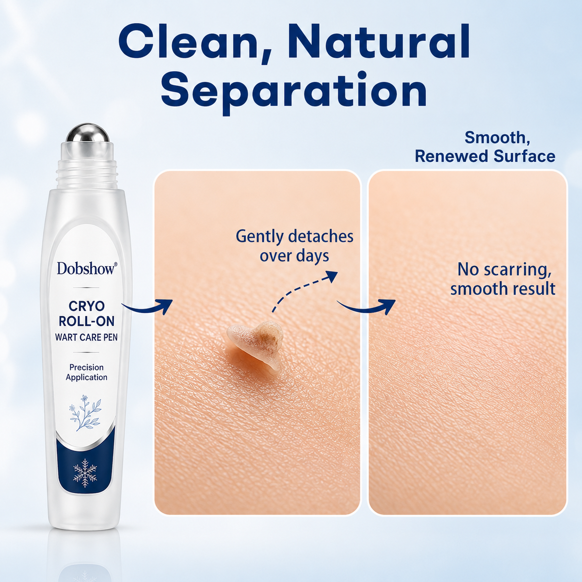 🔥100K+ SOLD 🔥 Dobshow® Newly Upgraded Precision Wart & Dark Spot Corrector Pen 🌿🎯